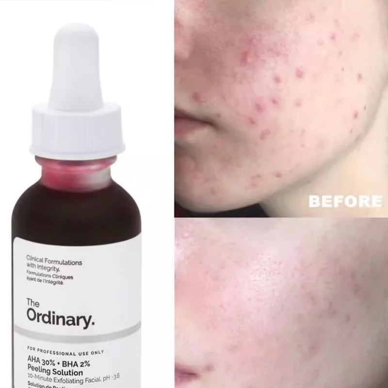 The Ordinary AHA 30% + BHA 2% Peeling Solution 30 ml
