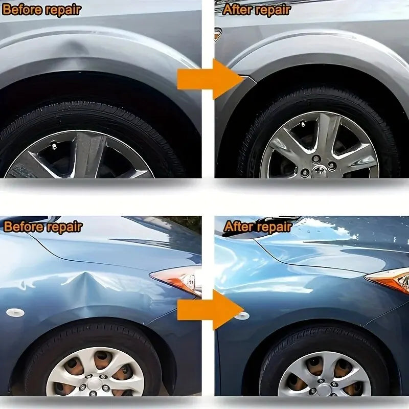 Buckelborttagare för Bil – Paintless Dent Repair Kit med Sugkoppar